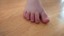 Wat kan ik adviseren aan de ouders over de voeten van dit kind van 8 - 1 Miniatuurvoorbeeld
