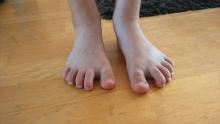 Wat kan ik adviseren aan de ouders over de voeten van dit kind van 8 - 3 Miniatuurvoorbeeld